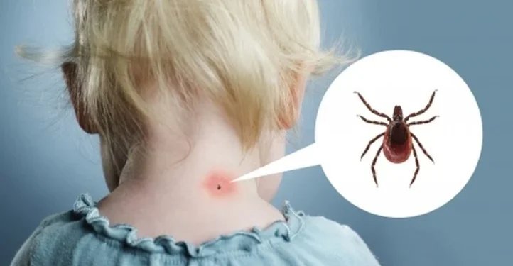 Počela je sezona krpelja: Evo kako ga pravilno ukloniti iz kože