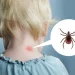 Počela je sezona krpelja: Evo kako ga pravilno ukloniti iz kože