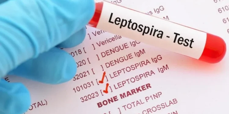 Leptospiroza, zarazna bolest koja se pojavila u Sarajevu, simptomi i kako se prenosi