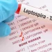 Leptospiroza, zarazna bolest koja se pojavila u Sarajevu, simptomi i kako se prenosi